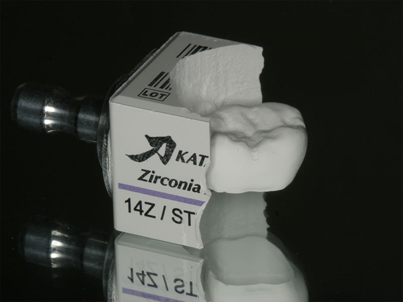 Einzelkrone CEREC Methode