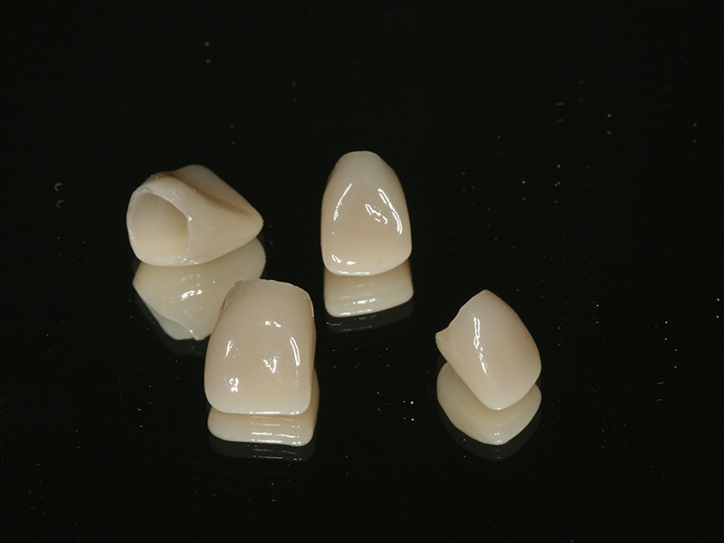 Frontzähne CEREC Methode