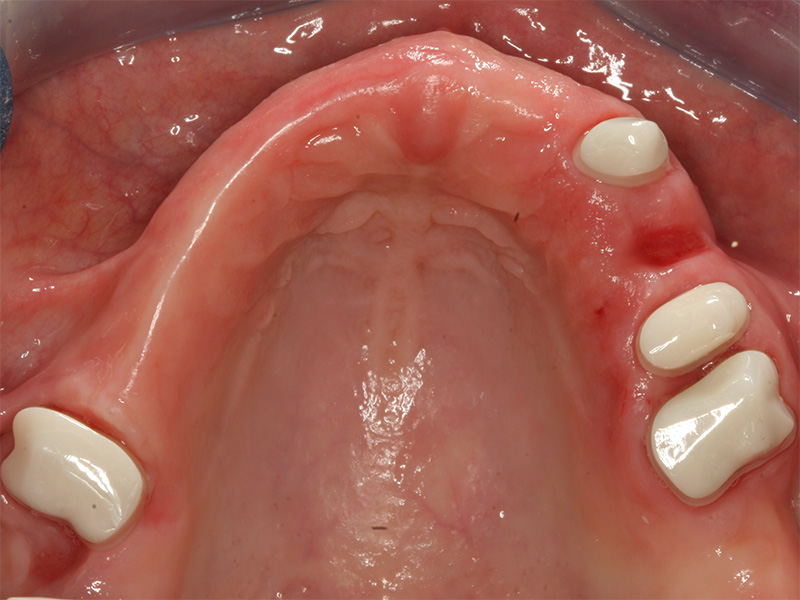 Große prophetische Versorgung