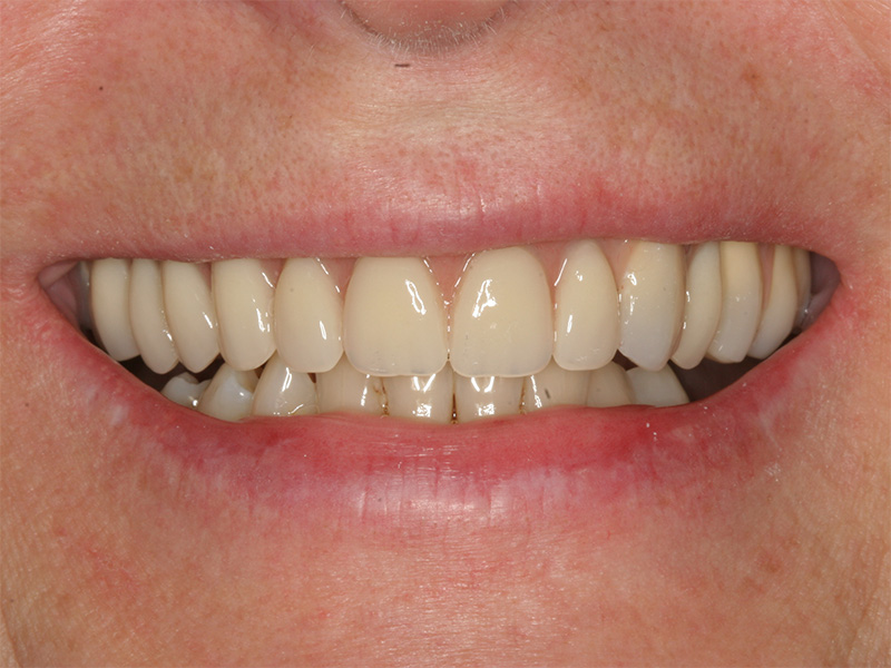 Große prophetische Versorgung