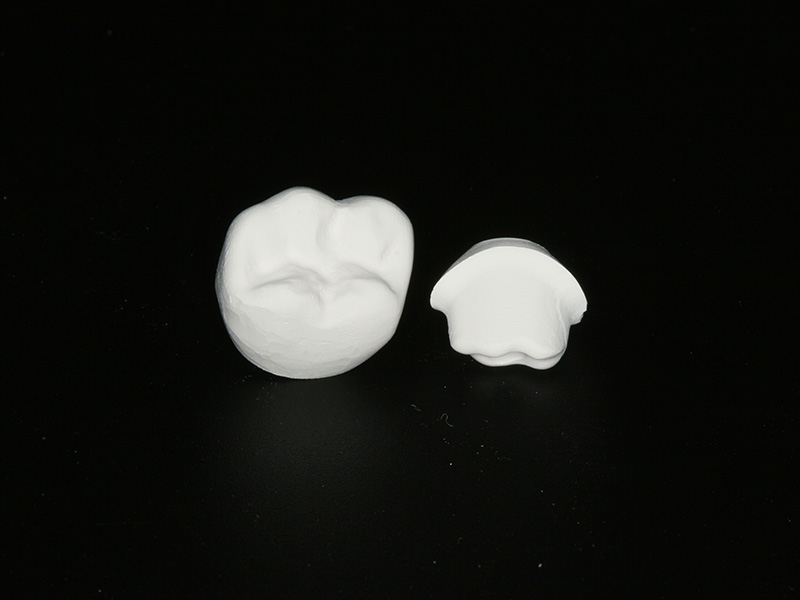 Implantatkrone CEREC Methode