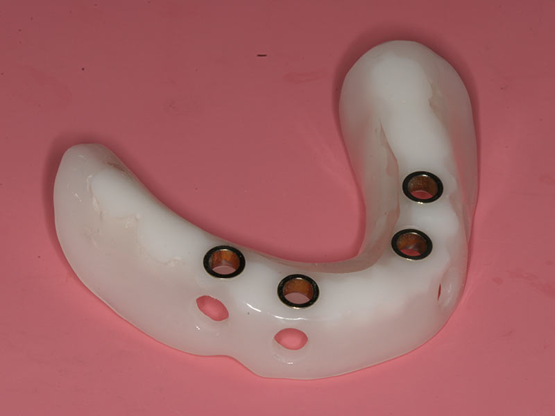 Implantation ohne Skalpell