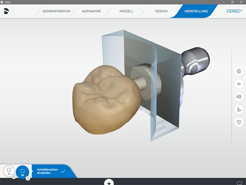 Vollkeramischer Zahnersatz